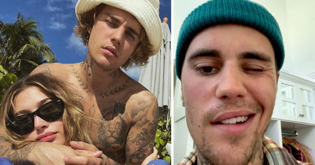 what happened to justin bieber?